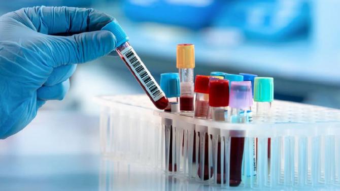 Phlebotomy hub closures 'will put more pressure on the health service'